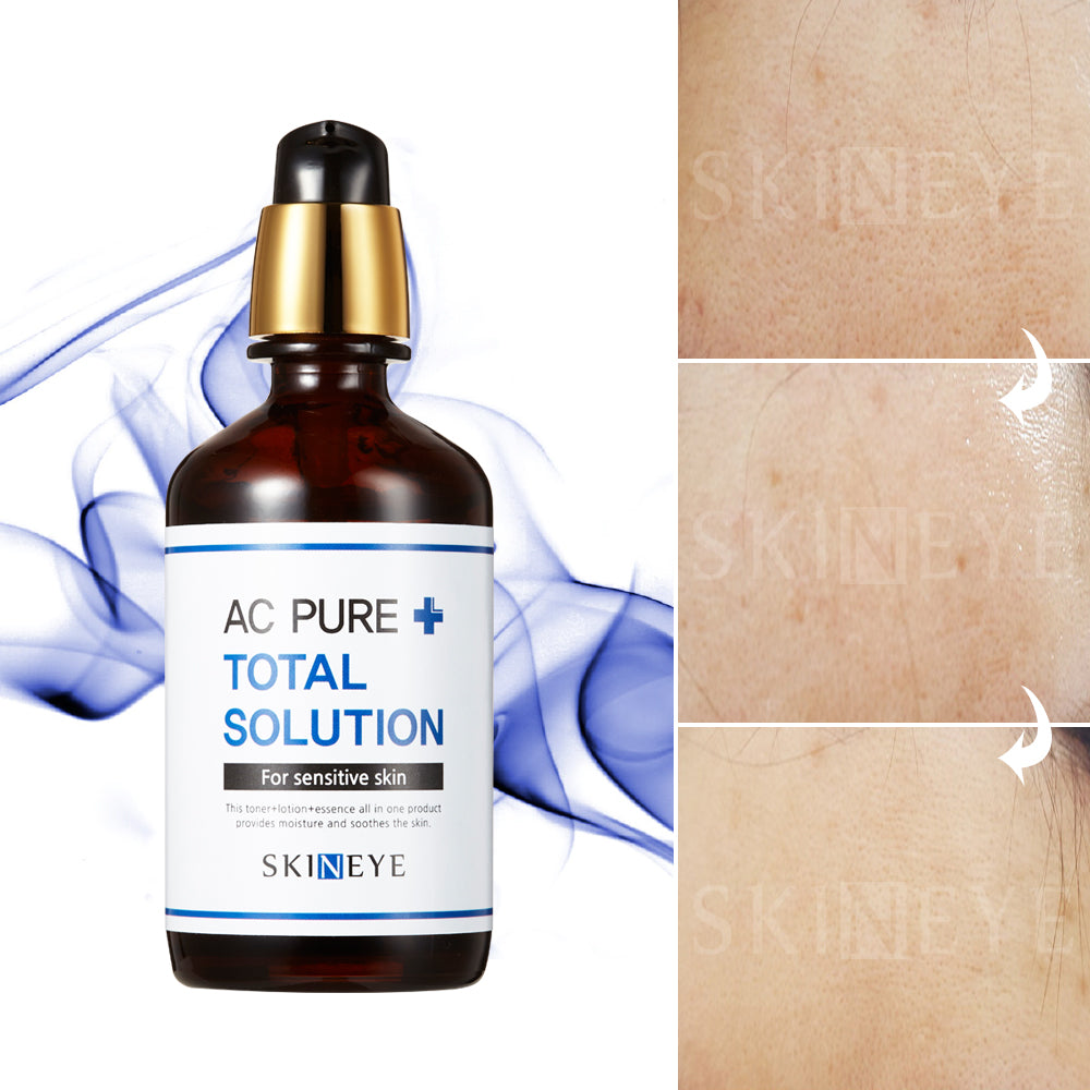 SKINEYE AC PURE TOTAL SOLUTION