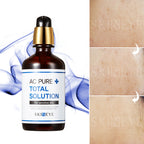 SKINEYE AC PURE TOTAL SOLUTION